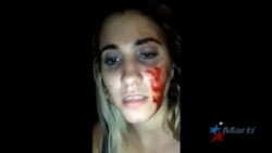 Youtuber cubana denuncia apatía de autoridades tras intento de violación