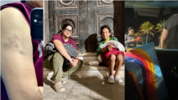 Fotos de RRSS de Yamilka Lafita, moretones tras su detención, escena de su labor con personas desamparadas y operativo policial.