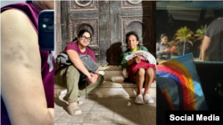 Fotos de RRSS de Yamilka Lafita, moretones tras su detención, escena de su labor con personas desamparadas y operativo policial.