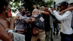 El fotógrafo de AP, el español Ramón Espinosa, aparece con heridas en la cara mientras cubría una manifestación contra el presidente cubano Miguel Díaz-Canel en La Habana, el 11 de julio de 2021