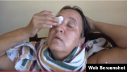 Falta de medicamentos para tratar la conjuntivitis hemorrágica golpea a los cubanos
