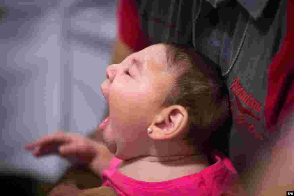 Una bebé con microcefalia recibe atención médica en una clínica de Recife, Brasil.