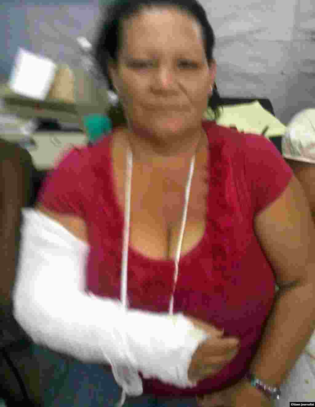 A la activista Graciela Dominguez le fracturaron un brazo.