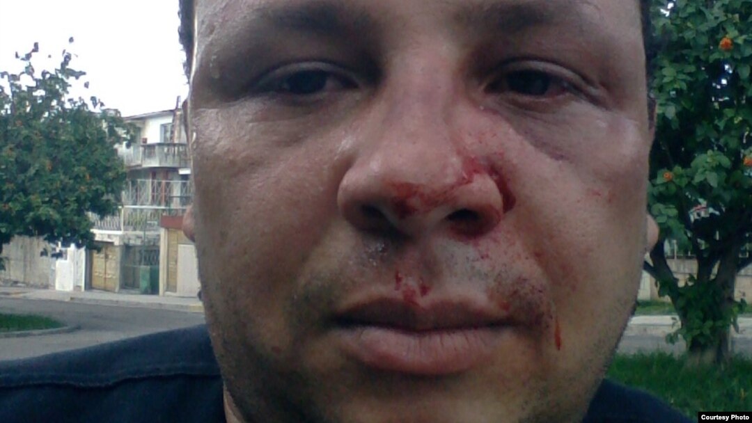 El periodista independiente Roberto de Jesús es golpeado en La Habana
