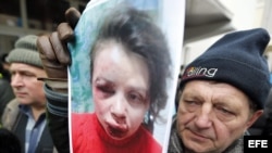 Imágen de la periodista Tatiana Chernobil tras ser agredida. 