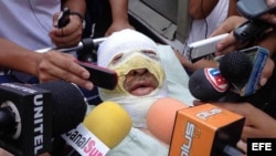 Fotografía de este 29 de octubre muestra al periodista boliviano Fernando Vidal, haciendo declaraciones a los medios en Yacuiba (Bolivia) donde fue quemado por desconocidos cuando conducía un programa radial.