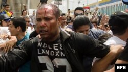Fotografía del teniente de la GNB en condición de retiro Danny José Subero (34 años) luego de ser golpeado y baleado en una manifestación en el estado de Lara.