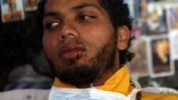 Estudiante venezolano suspenderá huelga de hambre 