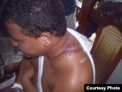 Goar Cruz, activista de UNPACU agredido con un machete