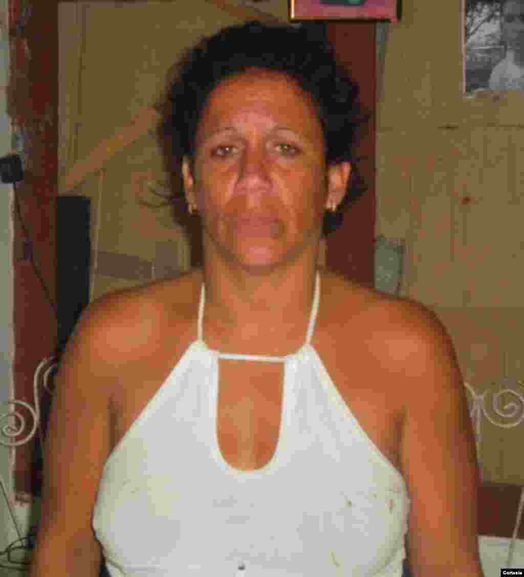 Dama de Blanco Niurka Luque muestra golpes recibidos durante una detenci&oacute;n policial&nbsp; previo a la visita del Papa a Cuba.