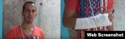 Reporta Cuba Ruben Darío le fracturaron un brazo