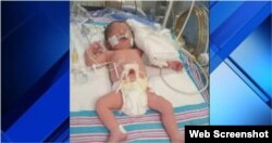 Valeria Gattorno nació prematura. No podrá salir de EEUU hasta que los médicos no lo autoricen.