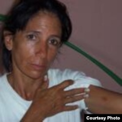 Dama de Blanco Leticia Herrería agredida en julio 21 Cárdenas