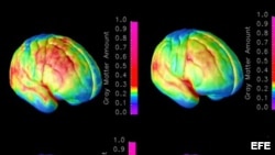 Combo de imágenes que muestran el progreso de maduración del cerebro. 