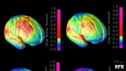 Combo de imágenes que muestran el progreso de maduración del cerebro. 