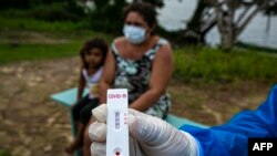 Una trabajadora sanitaria del gobierno muestra el resultado de una prueba de COVID-19 tomada el lunes en la isla de Marajó, en el estado de Pará en Brasil.(Tarso Sarraf/AFP).
