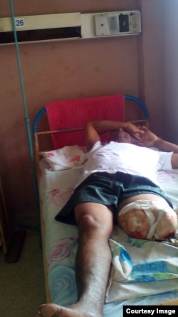 Alcibiades Silva, opositor cubano, permanece hospitalizado tras amputación de una pierna.