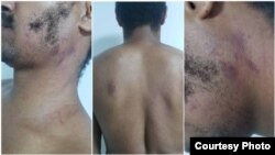 Luis Manuel Otero Alcántara muestra los golpes recibidos durante la detención en una unidad de policía. Tomado de su perfil de Facebook 