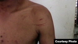 Fariñas, golpeado por paramilitares.
