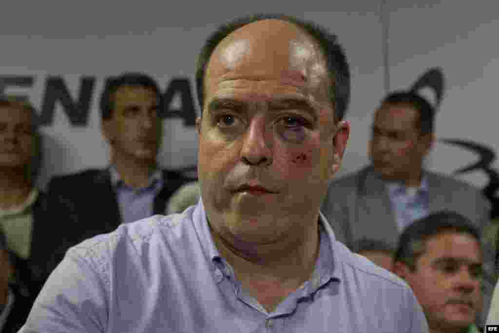 CAR102. CARACAS (VENEZUELA), 29/04/2013.- El diputado opositor Julio Borges participa en una rueda de prensa hoy, 30 de abril de 2013, en la sede de la Asamblea Nacional, en Caracas (Venezuela). Varios diputados de la oposición fueron golpeados este marte
