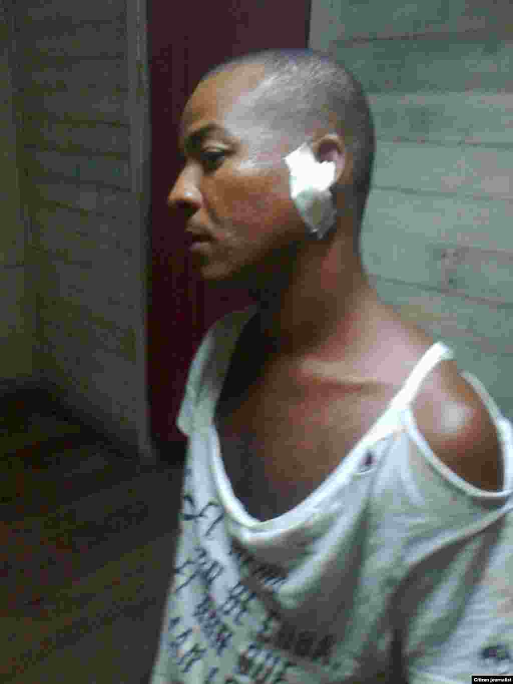 Reporte ciudadano desde Santiago de Cuba de un activista que fue detenido y golpeado cuando participaba en una marcha cívica.