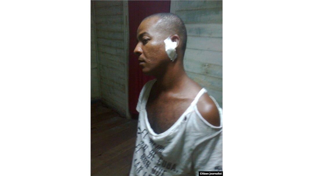 Reporte ciudadano desde Santiago de Cuba donde un activista fue golpeado durante el arresto policial.