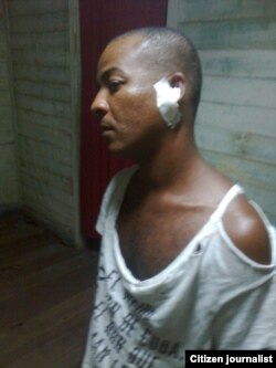 Reporte ciudadano desde Santiago de Cuba donde un activista fue golpeado durante el arresto policial.