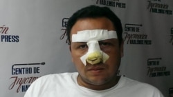 Human Rights First condena maltratos a periodista independiente cubano