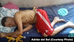 Guillermo del Sol en huelga de hambre en su casa en Santa Clara.