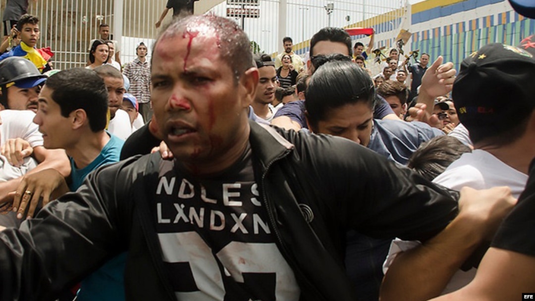 Fotografía del teniente de la GNB en condición de retiro Danny José Subero (34 años) luego de ser golpeado y baleado en una manifestación en el estado de Lara.