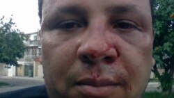 Sigue en libertad agresor de Guerra Pérez