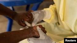 FOTO DE ARCHIVO: Un enfermero de laboratorio toma una muestra de un paciente sospechoso de viruela del mono, en la República Democrática del Congo, el 19 de julio de 2024. REUTERS/Arlette Bashizi/Foto de archivo