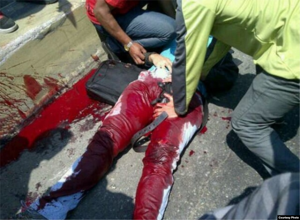 José Día, profesor de inglés del IUTEPI, Valencia, herido gravemente