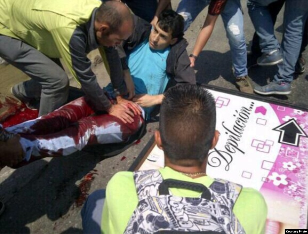 José Día, profesor de inglés del IUTEPI, Valencia, herido gravemente