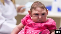 Alipio Martins sostiene a su hija Ana Beatriz, que padece microcefalia, durante una cita médica en la Fundación Altino Ventura, en Recife