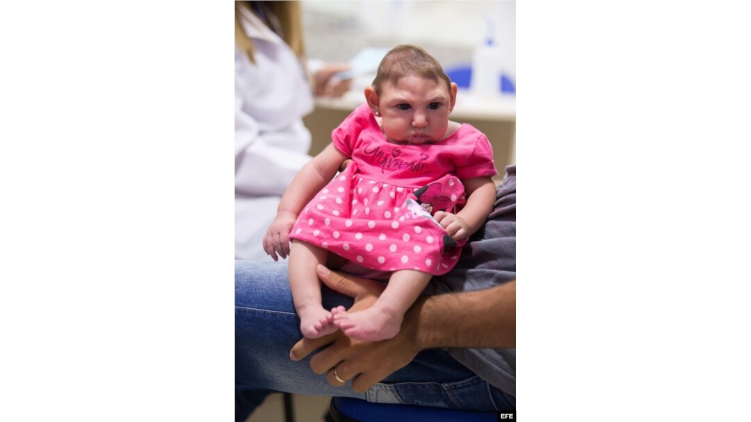 Alerta sanitaria por el virus del zika