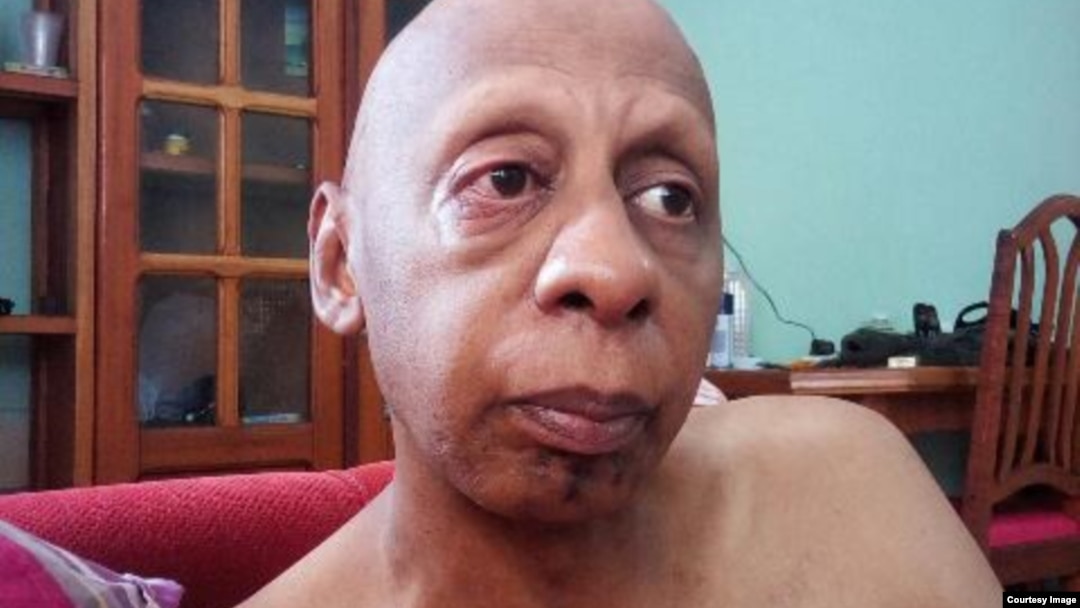 La salud de Fariñas se deteriora tras 46 días en huelga de hambre.
