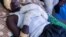 Faouzi Abdulbagi Mahammat Anour, 18, injured by a drone in Tina, Sudan, is lying in a bed at Tiné hospital, Chad, on June 18, 2026.
