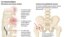  INFOGRAFIA : OSTEOPOROSIS , UNA AMENAZA SILENCIOSA