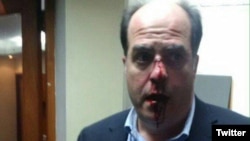 Diputado opositor venezolano, Julio Borges, publicada en su cuenta de Twitter