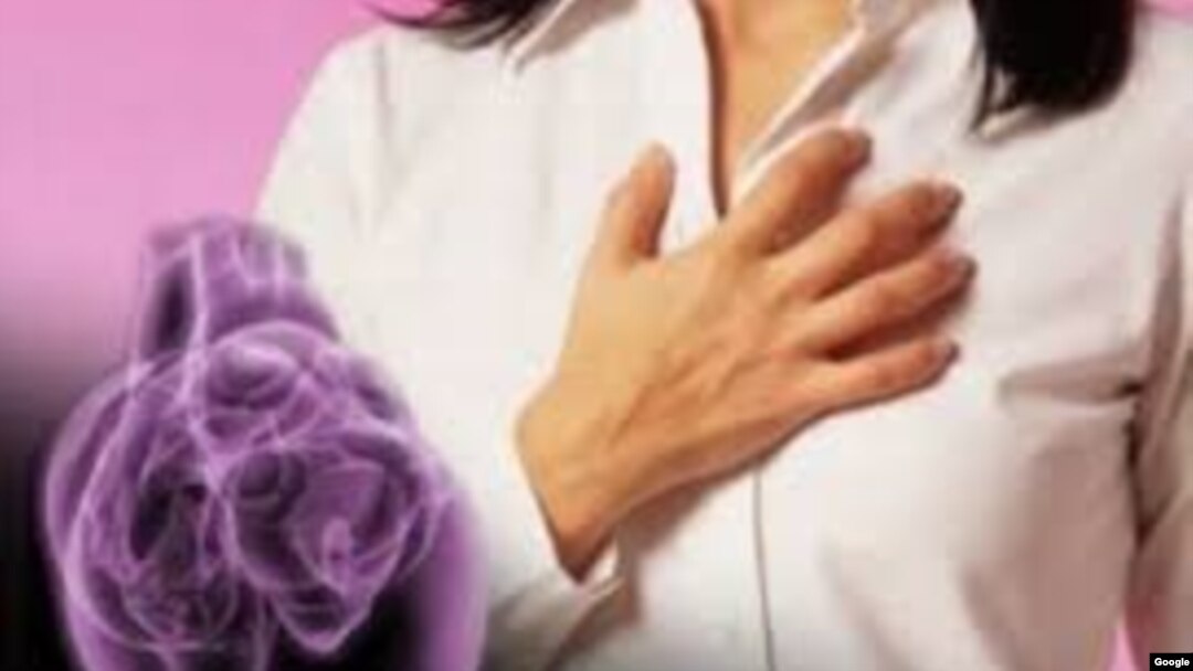 La herramienta permite evaluar la posibilidad de un accidente cardiovascular.