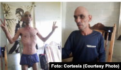 Carlos Michael Morales luego de su última huelga de hambre en prisión.