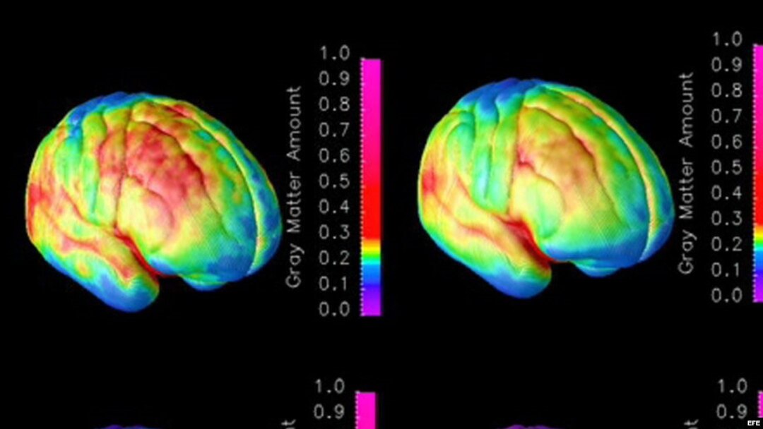 Combo de imágenes que muestran el progreso de maduración del cerebro. 
