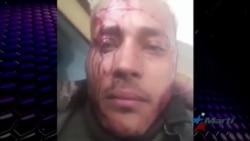 Muerte de Oscar Pérez reaviva malestar de los ciudadanos en Venezuela