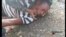 En coma diabético migrante cubano en huelga de hambre en Panamá