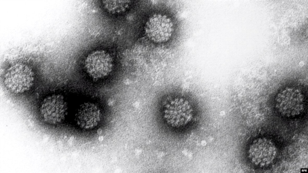 Imágen de microscopio del virus del papiloma humano, facilitada por el Instituto Alemán de Investigaciones sobre el Cáncer (DKFZ).