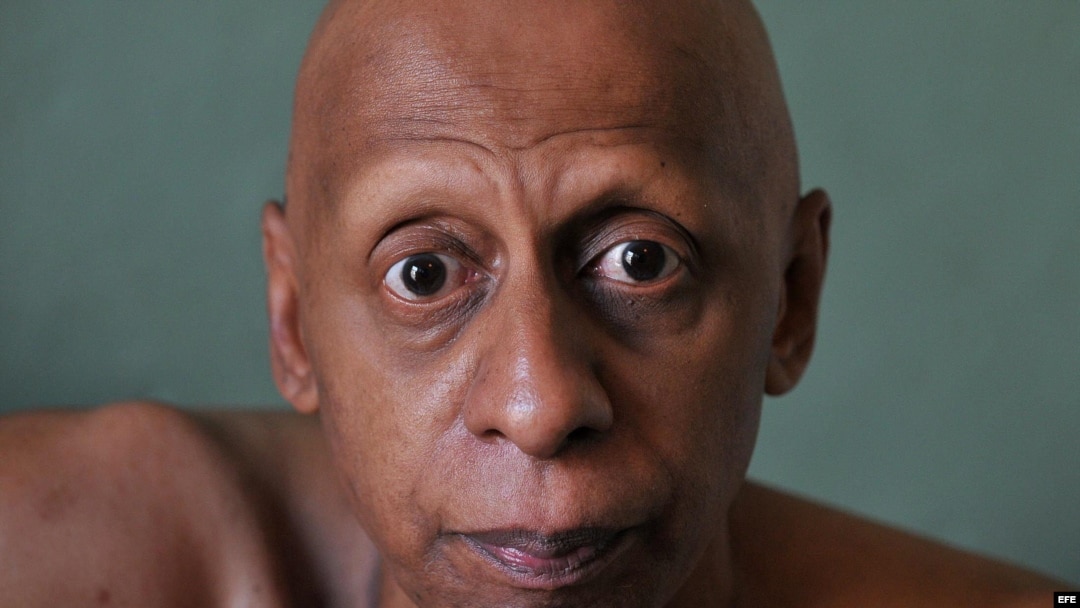 El disidente cubano Guillermo Fariñas, premio Sájarov 2010 a la libertad de conciencia, en foto de archivo