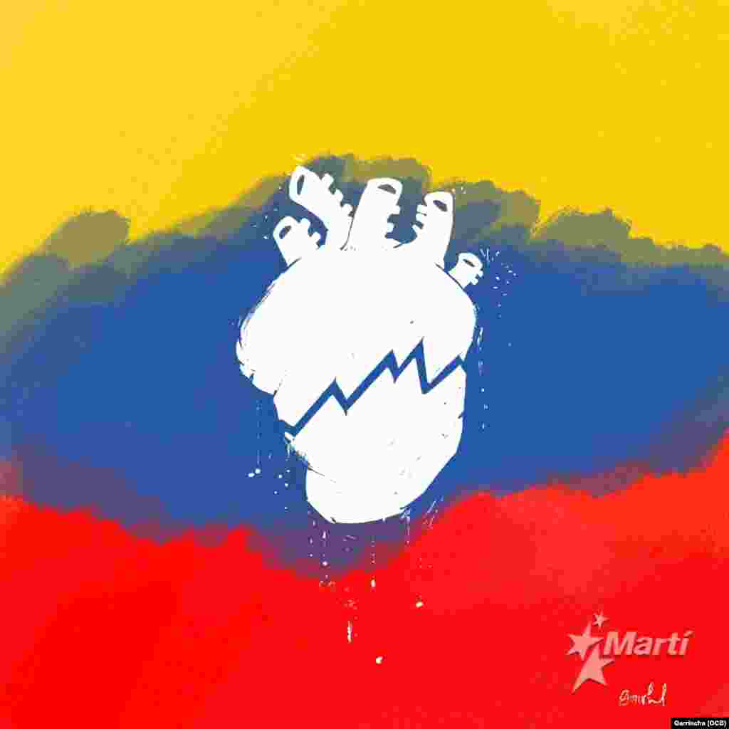 Venezuela duele.