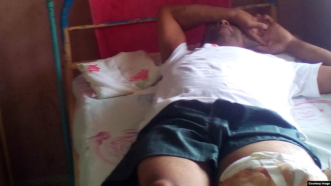 Alcibiades Silva, opositor cubano, permanece hospitalizado tras amputación de una pierna.