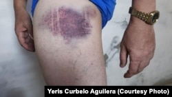 Acto de repudio con presencia policial deja agresiones a periodista independiente en Caimanera tras su reciente liberación